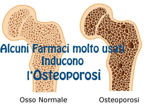 Farmaci che possono danneggiare le ossa creando Osteoporosi